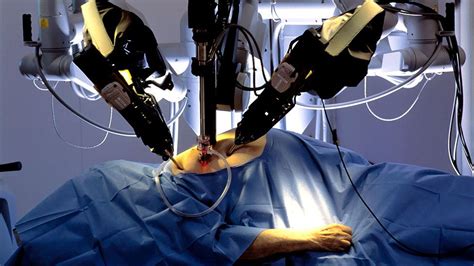 givenchy robotic surgery